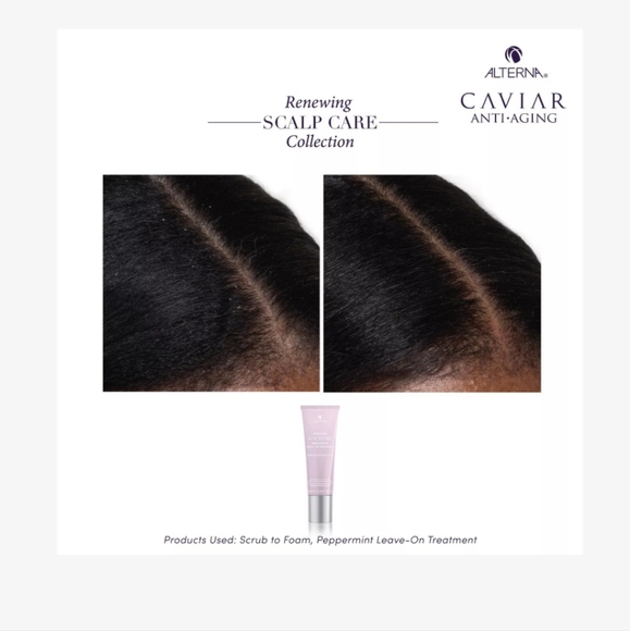 Alterna Renewing Scalp Care Leave-On Treatment - Picture 6 of 16